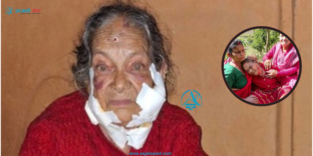 प्यूठानको झिमरुकमा ७५ वर्षिय बृद्धमाथी लुटपाट त्यसपछि कुटपिट