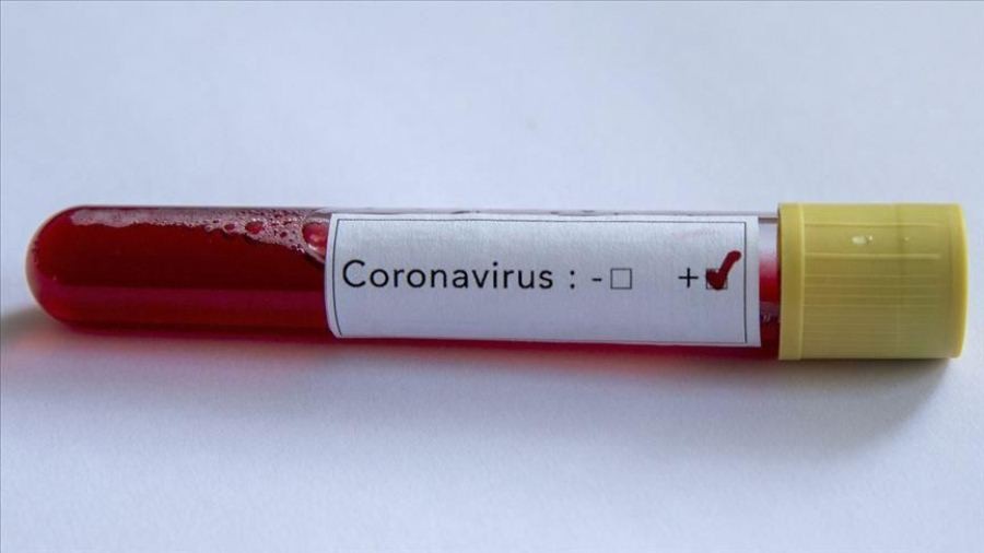 सुदूरपश्चिममा भेटिए ३ कोरोना संक्रमित